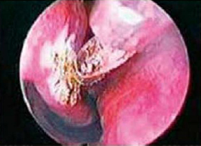 ファイバー画像